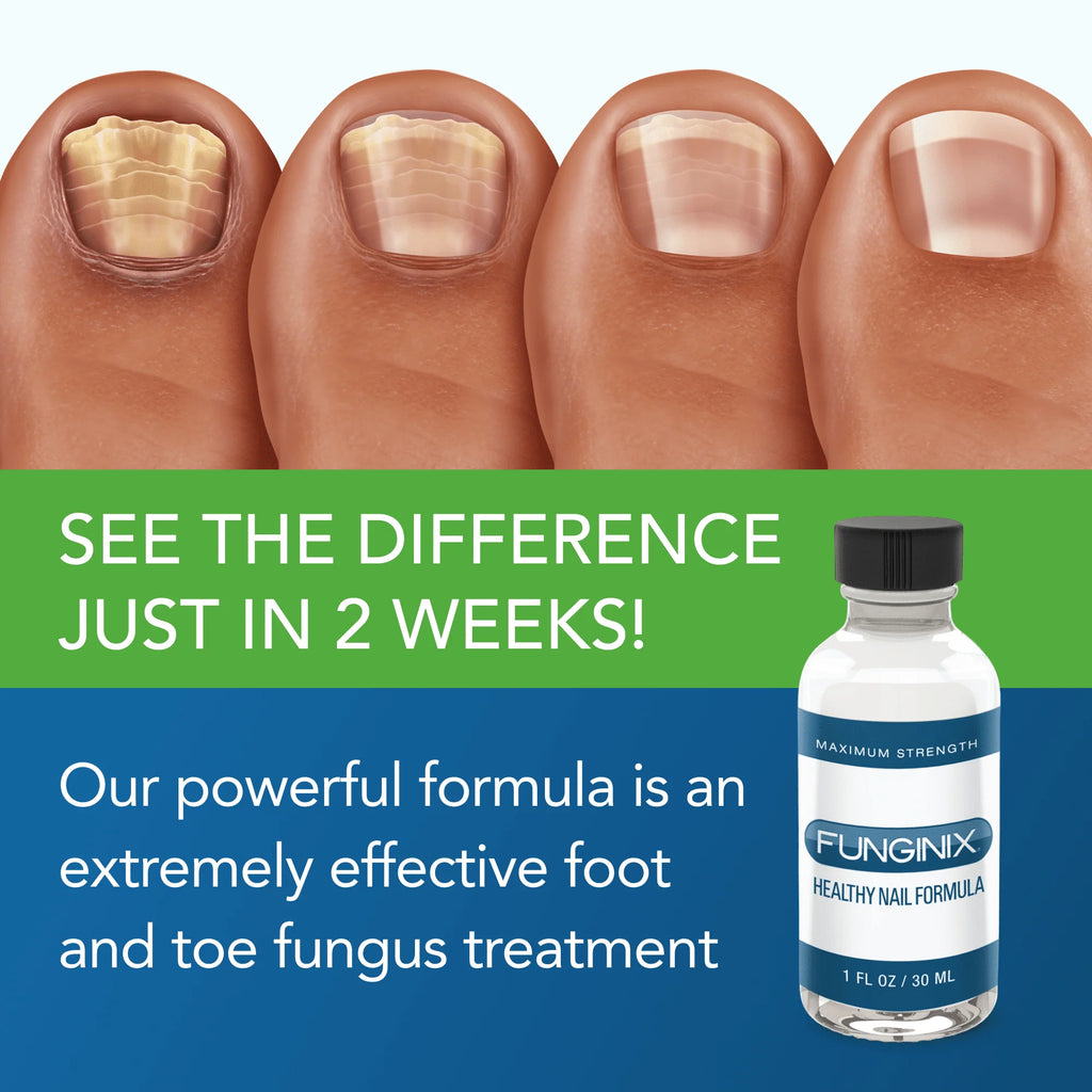 Anti-Fungal Nail Formula 1 fl oz A26108